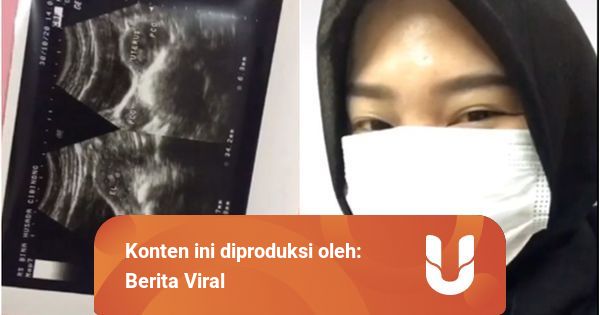 Perempuan Ceritakan Dirinya 10 Bulan Tidak Haid, Lemes Ternyata